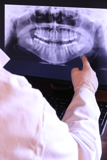 Best Emergency Wisdom Teeth Removal in Dekal, IL